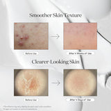 VT COSMETICS CICA Reedle Shot 100 Essence (1.69 fl oz/50ml)