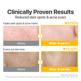 Numbuzin No.5 Vitamin-Niacinamide Concentrated Toner Pads - 70 Pads (6.08 fl oz/180ml)