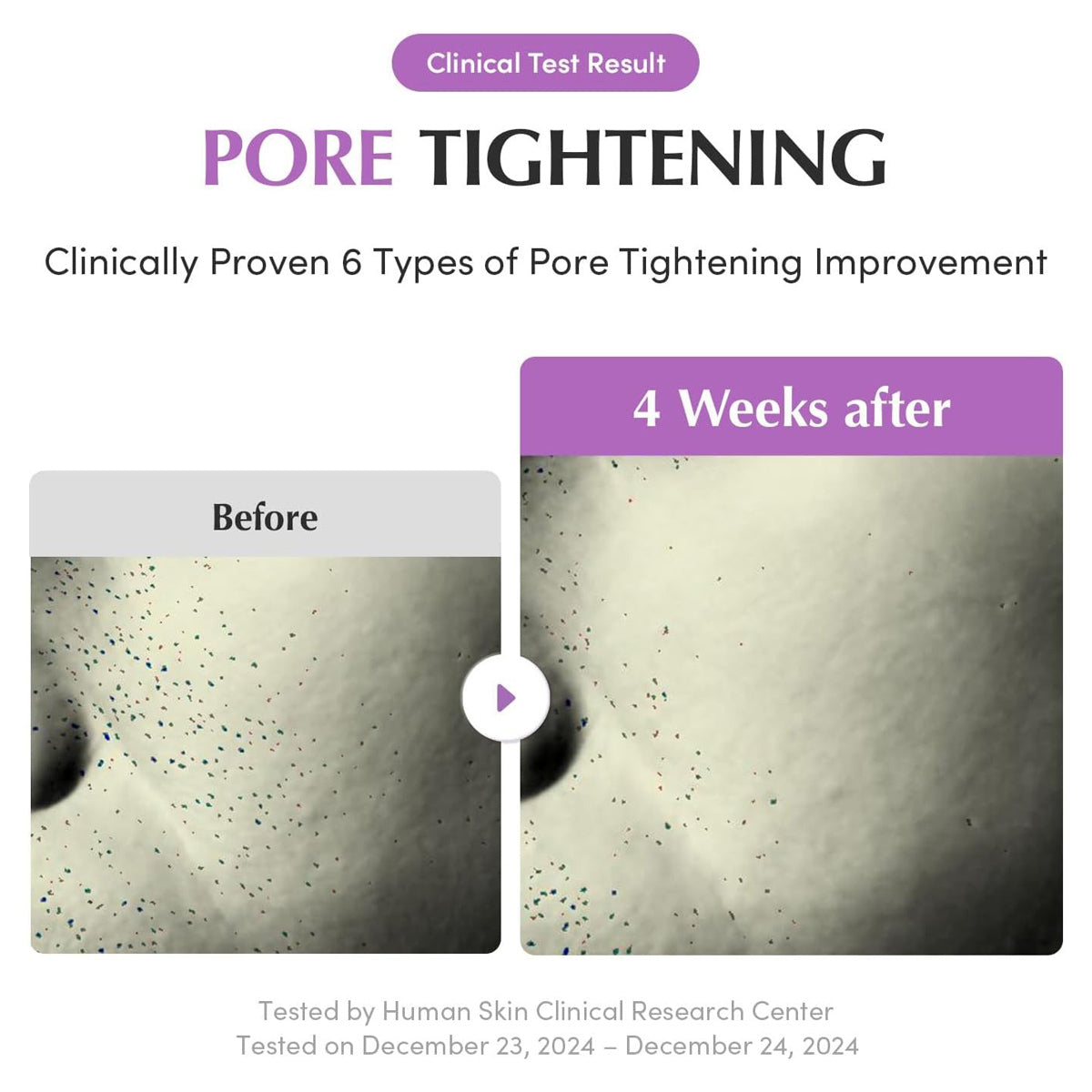 EQQUALBERRY Purple PDRN Pore Minimising Serum - Vegan Collagen & Peptides (1.01 fl oz/30ml)