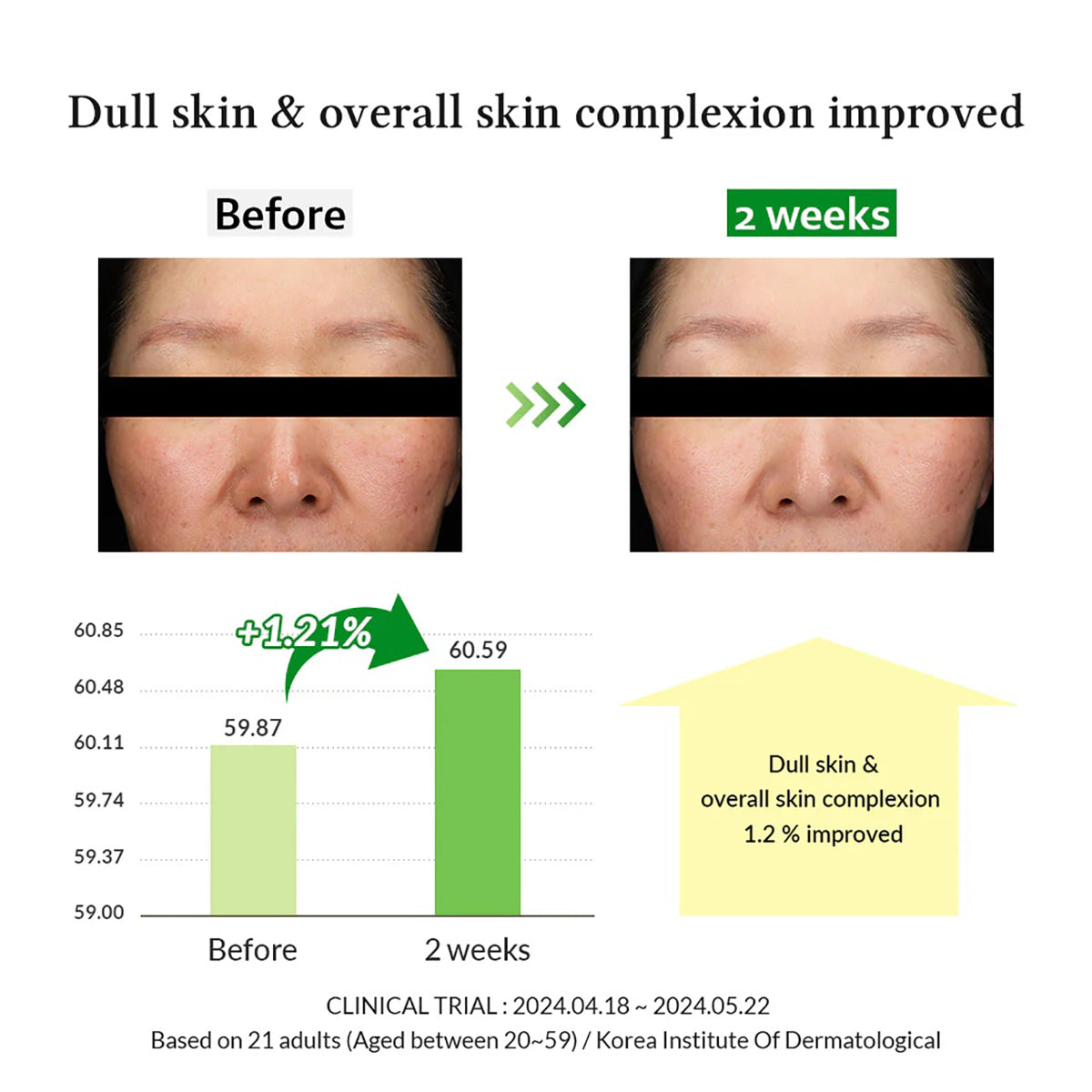 Dr.Althea Gentle Vitamin C Serum | Benefits Skin Tone and Pigmentation (30ml)