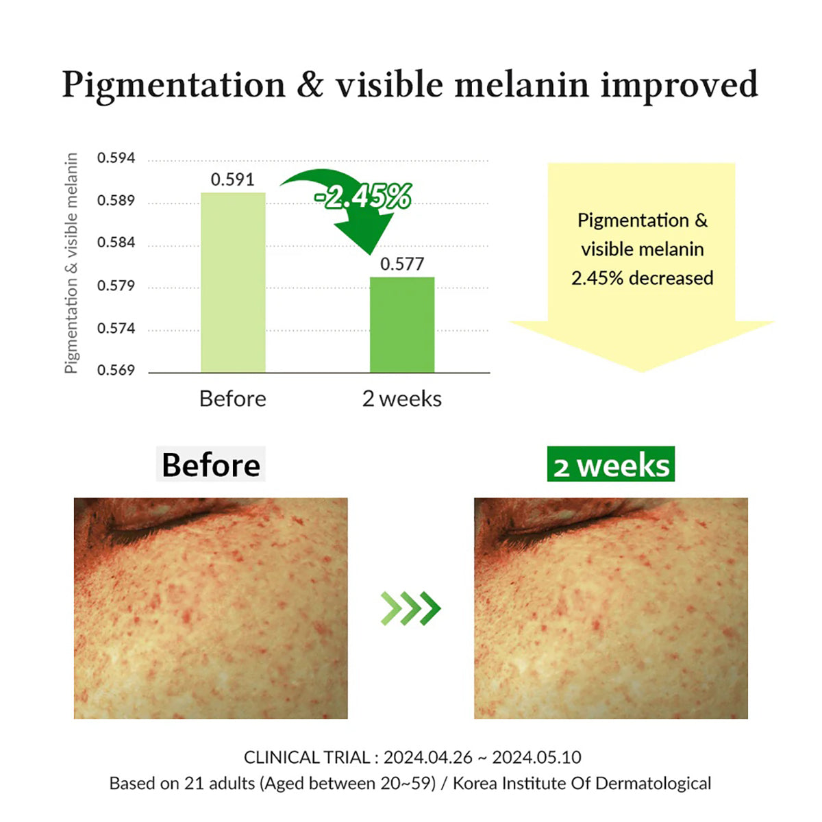 Dr.Althea Gentle Vitamin C Serum | Benefits Skin Tone and Pigmentation (30ml)