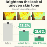 AXIS-Y Dark Spot Correcting Glow Serum 50ml