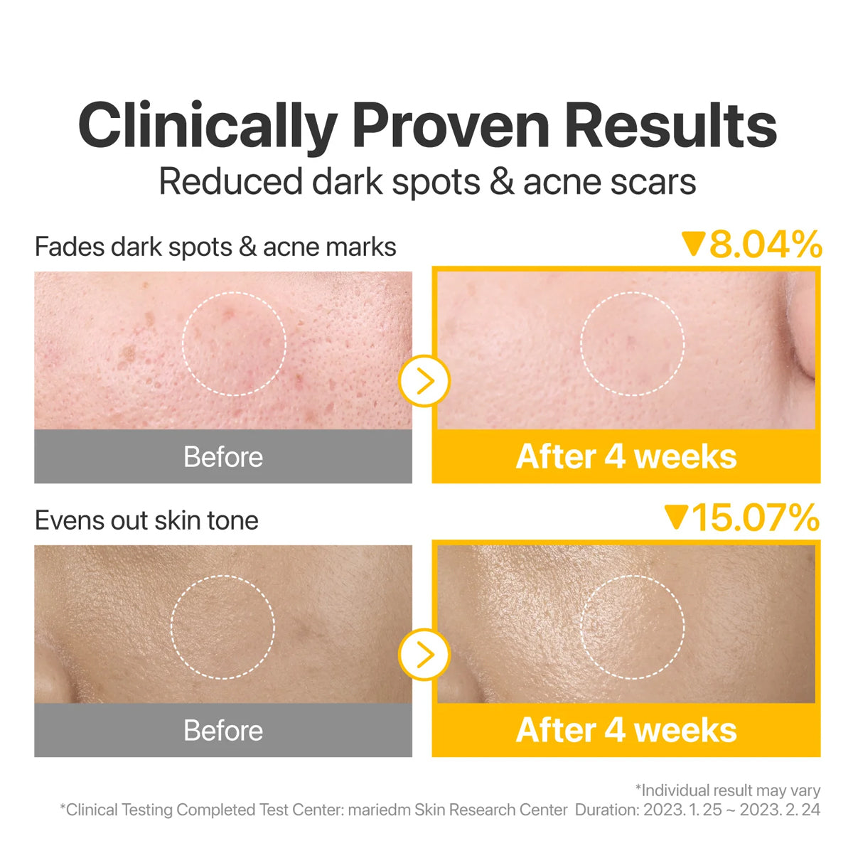 Numbuzin No.5 Vitamin-Niacinamide Concentrated Toner Pads - 70 Pads (6.08 fl oz/180ml)